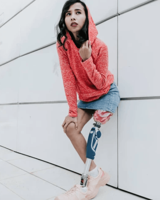 Modeling after Amputation: Rosalina's Story - Liberare