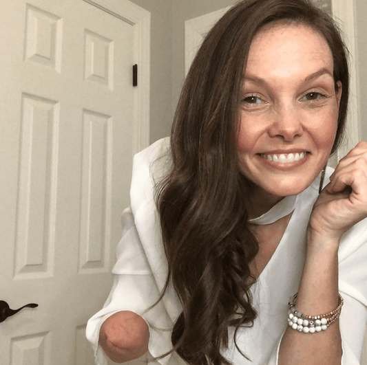 What Life is Like as an Amputee - Liberare